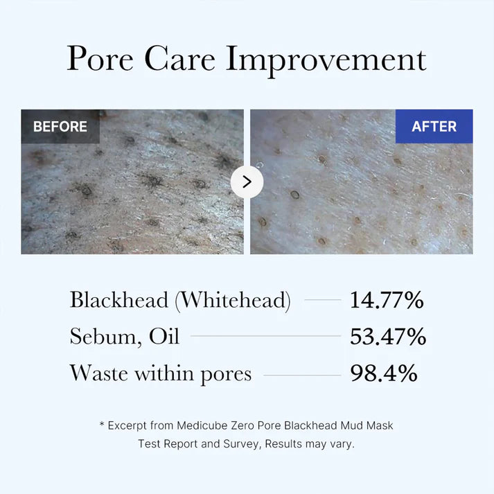 Medicube+ Zero Pore Blackhead Mud Mask - pore care improvement before after clinical results